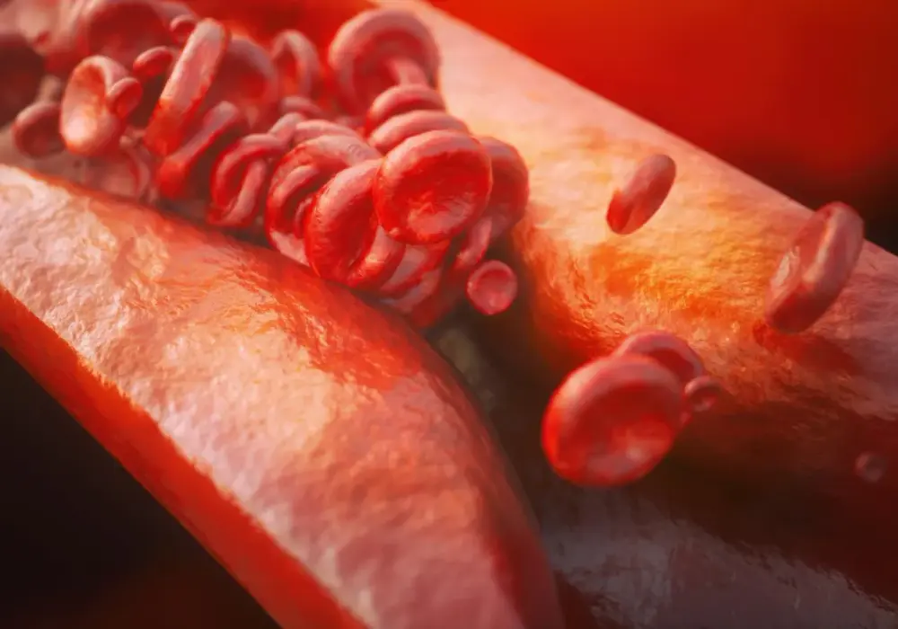 Czym grozi wysoki cholesterol? Poważne zagrożenia dla zdrowia