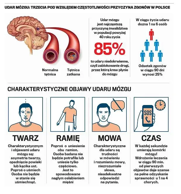 Pierwsze objawy udaru – jak je rozpoznać i dlaczego nie wolno ich ignorować?