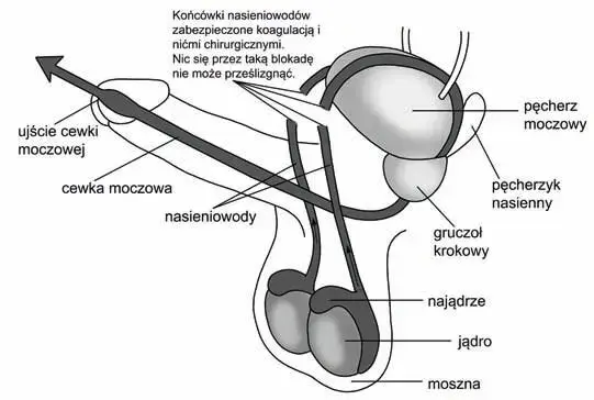 Czy wazektomia to grzech? Zrozumienie nauki Kościoła katolickiego