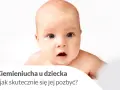 Urocze niemowlę z zaciekawioną miną. Tekst informuje o ciemieniuchy u dziecka i sposobach jej usuwania.