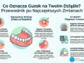 Ilustracja pokazuje ropień zęba, czyli bolesne zgrubienie na dziąśle wypełnione ropą, często spowodowane infekcją.