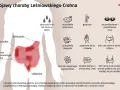Objawy choroby Leśniowskiego-Crohna: krew w stolcu, zmęczenie, gorączka, problemy z oczami, biegunka, bóle brzucha, zapalenie skóry i stawów.