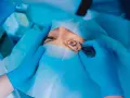 Chirurgo esegue trabeculectomia glaucoma, un intervento per ridurre la pressione oculare.