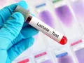 Ręka w niebieskiej rękawiczce trzyma probówkę z krwią do testu na mleczany. Wynik może pomóc zdiagnozować kwasicę mleczanową.