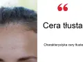 Tłusta cera? Poznaj sprawdzone sposoby na matową skórę bez błyszczenia.