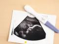 USG pokazuje pęcherzyk ciążowy, a obok leży pozytywny test ciążowy.