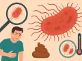 Uomo con mal di pancia, feci arancioni, batteri visti al microscopio e termometro.