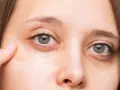 Application de correcteur pour comment cacher les cernes sous les yeux.