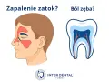 Zapalenie zatok czy ból zęba? Nawet delikatny dotyk językiem może wywołać ostry ból zęba, gdy problem dotyczy nerwów.