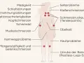 Fibromyalgie symptome: Müdigkeit, Schlafstörungen, Kopfschmerzen, Muskelschmerzen, Übelkeit, Hautprobleme, Sehprobleme, Kiefer- und Gelenkschmerzen, Konzentrationsschwierigkeiten, Schwindel, Harnwegsprobleme, Morgensteifigkeit, Unruhe der Beine.
