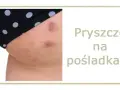Jak szybko wysuszyć pryszcza? Skuteczne metody i czego unikać