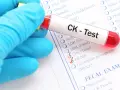 Ręka w niebieskiej rękawiczce trzyma probówkę z krwią do testu CK, czyli kinazy kreatynowej. Zaznaczono opcje CPK (Total) i CK-MB.