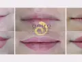 Permanent Make-up Lippen: Lohnt es sich? Der ehrliche Erfahrungsbericht