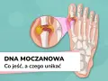 Dna moczanowa: powiększony staw palucha z kryształkami kwasu moczowego. Objawy dny moczanowej mogą być bolesne.