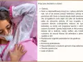 Dziecko z maską CPAP, które może mieć bezdech. Na ekranie lista przyczyn bezdechu u dziecka.