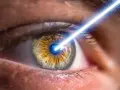 Un occhio solo, con un raggio laser che lo colpisce.
