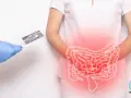 Ból brzucha u dziecka: Czy to IBS? Diagnostyka i badania.