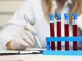 Laborantka w rękawiczkach zapisuje wyniki badań krwi z probówek.