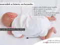 Nieprawidłowe leżenie na brzuchu niemowlaka: ciężar ciała wysoko, główka na policzku, nóżki zgięte. Miednica uniesiona.