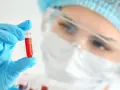 W laboratorium mikrobiologicznym analizuje się próbki, jak ta z krwią, by wykryć i badać mikroorganizmy.