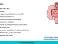 Ilustracja przedstawia jelita, które mogą być powiązane z **sibo przyczyny**. Spis treści omawia dietoterapię i sposoby radzenia sobie z problemami jelitowymi.