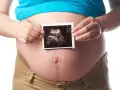 Schwanger in der 21. SSW: Ein Ultraschallbild zeigt das Baby.