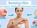 Infographic on sensitive skin, showing redness, hydration, patch testing, and avoiding harsh products. Essential skincare tips for sensitive skin.