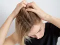 Kobieta sprawdza skórę głowy, na której widoczne są oznaki łupieżu. Czas na skuteczny peeling do włosów!