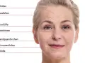 Nahaufnahme einer Frau mit Stirnfalten, Zornesfalten und Krähenfüßen. Selbst mit 20 Jahren können erste Zeichen der Hautalterung sichtbar werden.