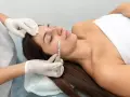 Une esthéticienne effectue un dermaplaning visage sur une femme allongée, utilisant un scalpel pour exfolier délicatement la peau.