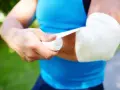 Person bandagiert Arm. Frage: was zahlt die unfallversicherung bei sehnenriss?