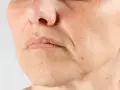 Nahaufnahme eines Gesichts mit sichtbaren Falten um den Mund. Die Frage "Falten ab wann?" beschäftigt viele.