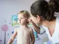 Madre aplica crema a su bebé con miliaria. El niño rubio tiene la piel cubierta de pequeñas erupciones blancas.