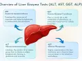 Schemat przedstawia enzymy wątrobowe: ALT, AST, GGT, ALP. AST to aspartaminotransferaza, kluczowa dla metabolizmu.