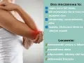 Dna moczanowa objawia się nagłym bólem stawu, obrzękiem i zaczerwienieniem. Leczenie obejmuje wizytę u lekarza, dietę i aktywność fizyczną.