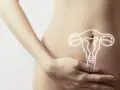 Kobieta z rysunkiem macicy na brzuchu. Po usunięciu macicy nie wolno podnosić ciężkich przedmiotów.