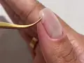 Pince dorée retirant délicatement un ongle arraché, révélant la peau sensible.