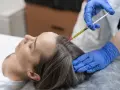 Una mano con guante azul aplica una inyección en el cuero cabelludo de una mujer, buscando aliviar el dolor y estimular el crecimiento del cabello.