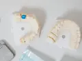 Co robić po wyrwaniu zęba? Skuteczne gojenie i unikanie bólu