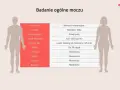 Tabela z badaniem ogólnym moczu. Wartość ciężar właściwy moczu za niski może wskazywać na problemy z nerkami.