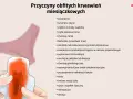 Ilustracja przedstawia higieniczną podpaskę z widocznym krwawieniem, symbolizującą, ile krwi traci kobieta podczas okresu. Obok lista przyczyn obfitych krwawień.