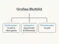 Schemat "Großes Blutbild" z podziałem na erytrocyty, leukocyty i trombocyty.