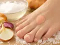 Un gros orteil avec un pansement rond, entouré d'oignons, d'ail et de sel.