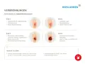 Verbrühungen: Grad 2 zeigt gerötete Haut, Blasenbildung und starke Schmerzen. Ein Arzt sollte ab Grad 2 konsultiert werden.