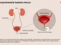 Ilustracja układu moczowego z zaznaczonymi nerkami, moczowodami i pęcherzem. W powiększeniu widoczne bakterie w moczu.