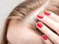 Dünnes Haar und sichtbare Kopfhaut bei Frauen: Ursachen und Lösungen