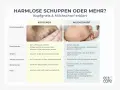 Baby kratzt sich am Kopf wegen Kopfgneis oder Milchschorf. Die Bilder zeigen die Unterschiede.