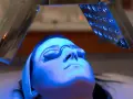 Woman receiving blue light therapy, exploring the blue light benefits for skin.