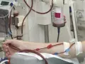 Ramię pacjenta podłączone do aparatury dializacyjnej z widocznymi przewodami i filtrem.