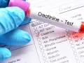 Rękawiczka w niebieskiej rękawiczce trzyma probówkę z oznaczeniem "Creatinine - Test". Zaznaczono "Creatinine". Pytanie o podwyższona kreatynina a picie wody.